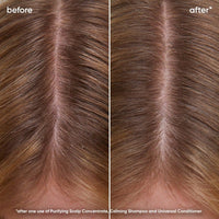 Scalp Sync Calming Shampoo
