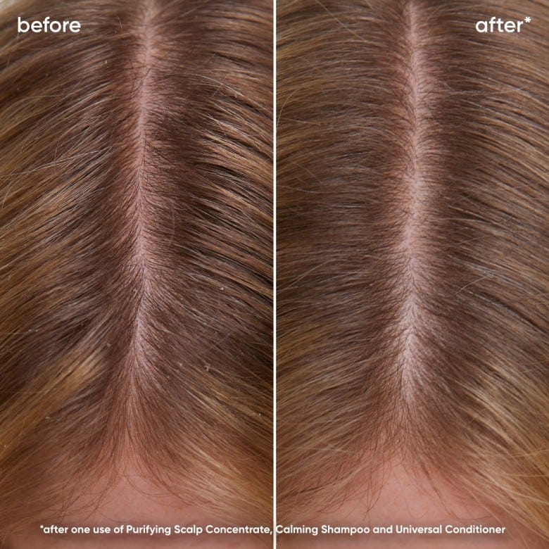 Scalp Sync Calming Shampoo
